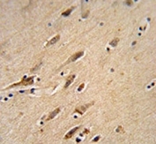 ARF1 antibody immunohistochemistry analysis in formalin fixed and paraffin embedded human brain tissue.