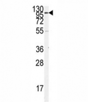 Western blot analysis of ACE2 antibody and K562 lysate. Predicted molecular weight: 90-100 kDa.