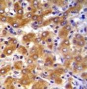 ABCB10 antibody immunohistochemistry analysis in formalin fixed and paraffin embedded human liver tissue.