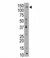 ABCB11 antibody western blot analysis with mouse liver tissue lysate