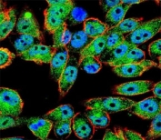 Confocal immunofluorescent analysis of TP53 antibody with A2058 cells followed by Alexa Fluor 488-conjugated goat anti-rabbit lgG (green). Actin filaments have been labeled with Alexa Fluor 555 Phalloidin (red). DAPI was used as a nuclear counterstain (blue).