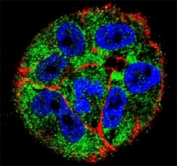 Confocal immunofluorescent analysis of p53 antibody with A2058 cells followed by Alexa Fluor 488-conjugated goat anti-rabbit lgG (green). Actin filaments have been labeled with Alexa Fluor 555 Phalloidin (red). DAPI was used as a nuclear counterstain (blue).