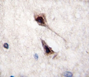 IHC analysis of FFPE human brain tissue stained with MEF2C antibody