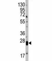 Western blot analysis of Claudin 1 antibody and mouse kidney tissue lysate