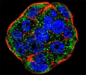 Confocal immunofluorescent analysis of FGF1 antibody with WiDr cells followed by Alexa Fluor 488-conjugated goat anti-rabbit lgG (green). Actin filaments have been labeled with Alexa Fluor 555 Phalloidin (red). DAPI was used as a nuclear counterstain (blue).