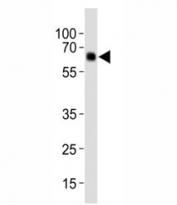 Western blot analysis of lysate from human placenta tissue, using Park6/ PINK1 antibody diluted at 1:1000. Predicted molecular weight: 60-70 kDa