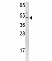 Western blot analysis of FLI1 antibody and 293 lysate.
