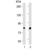 Western blot testing of 1) human liver and 2) mouse liver tissue lysate with ABCG1 antibody. Predicted molecular weight: 75~90 kDa.
