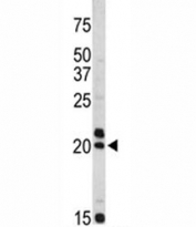 Western blot analysis of VIP antibody and Jurkat lysate. Predicted molecular weight ~19 kDa.