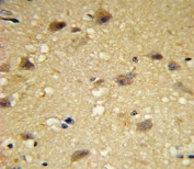 IHC analysis of FFPE human brain tissue with CCL2 antibody