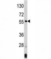 Western blot analysis of ANGPTL3 antibody and mouse liver tissue lysate. Expected molecular weight 50 ~ 63 kDa depending on glycosylation level.