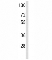 Western blot analysis of tPA antibody and A2058 lysate.