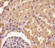IHC testing of FFPE human kidney with ASS1 antibody at 1:25 dilution. HIER: boil tissue sections in pH6, 10mM citrate buffer, for 10-20 min followed by cooling at RT for 20 min.