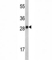 Western blot analysis of IL-2 antibody and MDA-MB231 lysate. Predicted molecular weight ~17 kDa