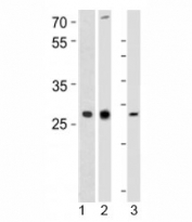 Western blot analysis of 1) human CEM, 2) rat PC-12, and 3) mouse spleen tissue lysate using LIF antibody at 1:1000. Observed molecular weight ~23/32~62kDa (unmodified/glycosylated).