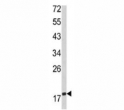 Western blot analysis of CD28 antibody and MDA-MB231 lysate. Expected molecular weight depending on level of glycosylation: ~25-44 kDa (monomer), ~50-90kDa (dimer).