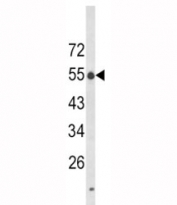 Western blot analysis of LAG3 antibody in K562 lysate. Predicted molecular weight ~54 kDa.