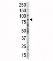 Western blot analysis of anti-PKC alpha antibody in placenta lysate