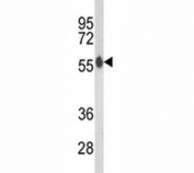 Western blot analysis of AKT2 antibody and mouse brain tissue lysate. Predicted molecular weight: ~56kDa.