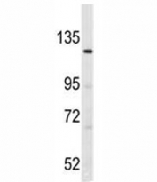Western blot analysis of LATS1 antibody and K562 lysate.