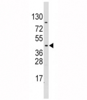 Western blot analysis of PDK4 antibody and CEM lysate. Expected/observed molecular weight ~46 kDa.