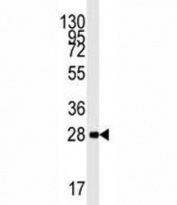 Western blot analysis of AMPK beta 1 antibody and mouse heart lysate. Expected molecular weight ~30 kDa.