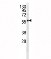 Western blot analysis of PKM2 antibody and CEM lysate. Predicted molecular weight ~58 KDa.