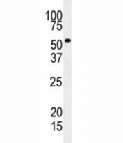 Western blot analysis of RIPK3 antibody and mouse cerebellum tissue lysate. Predicted molecular weight ~57 kDa.