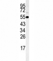 Western blot analysis of RIPK3 antibody and HeLa lysate