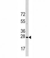 Western blot analysis of HSP27 antibody and HeLa lysate.