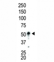 Western blot analysis of AMPK antibody and mouse liver lysate