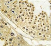 IHC analysis of FFPE human testis tissue stained with Aurora B antibody