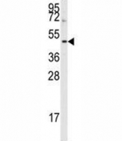 Western blot analysis of Aurora B antibody and HepG2 lysate. Predicted molecular weight: 39-45 kDa