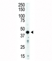 Aurora B antibody used in western blot to detect STK12/AuroraB in mouse spleen tissue lysate. Predicted molecular weight: 39-45 kDa
