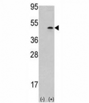 Western blot analysis of Aurora B antibody and 293 cell lysate (2 ug/lane) either nontransfected (Lane 1) or transiently transfected with the AURKB gene (2).