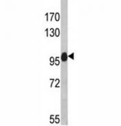Western blot analysis of anti-NLRP12 antibody and HL-60 lysate. Predicted molecular weight: ~119kDa, routinely observed at 100~119kDa.