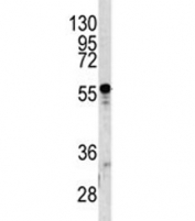 Western blot analysis of A1BG antibody and human T47D lysate. Predicted molecular weight ~55 kDa.