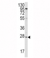 Western blot analysis of APOA1 antibody and HepG2 lysate. Predicted molecular weight ~30kDa.