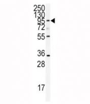 Western blot analysis of ADAMTS13 antibody and CEM lysate.