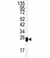 Western blot analysis of DCXR antibody and mouse lung tissue lysate. Predicted molecular weight: ~26kDa.