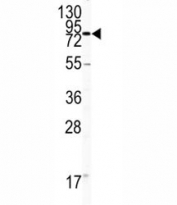 Western blot analysis of CD31 antibody and HL-60 lysate.