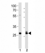 Cdk2 antibody western blot analysis in 293, HeLa lysate. Predicted molecular weight ~33 kDa.