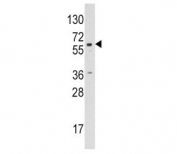Western blot analysis of CYP19A1 / Aromatase antibody and Jurkat lysate. Predicted molecular weight ~58 kDa.