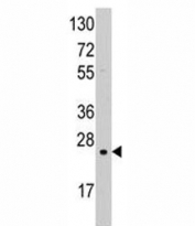 Western blot analysis of SOD2 antibody and K562 lysate. Predicted molecular weight ~ 25 kDa.