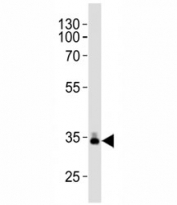 Western blot analysis of lysate from human plasma tissue lysate using ApoE antibody diluted at 1:1000. Predicted molecular weight: 34-37 kDa