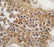 IHC analysis of FFPE human testis tissue stained with ALK antibody