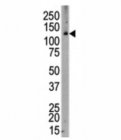Western blot analysis of CSF1R antibody and human placenta. Predicted molecular weight: 106-116 kDa.