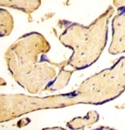 IHC analysis of FFPE human placenta tissue stained with EphA3 antibody