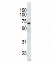 Western blot analysis of EphA3 antibody and CHO cell lysate. Predicted molecular weight: 110/61 kDa (isoforms 1/2).