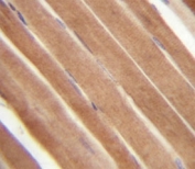 EphB2 antibody analysis in formalin fixed and paraffin embedded human skeletal muscle